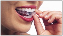 Invisalign1
